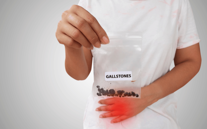 What are Gallstones Made Of