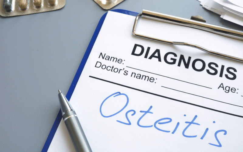 Alveolar Osteitis Identifying and Overcoming Jawbone Inflammation