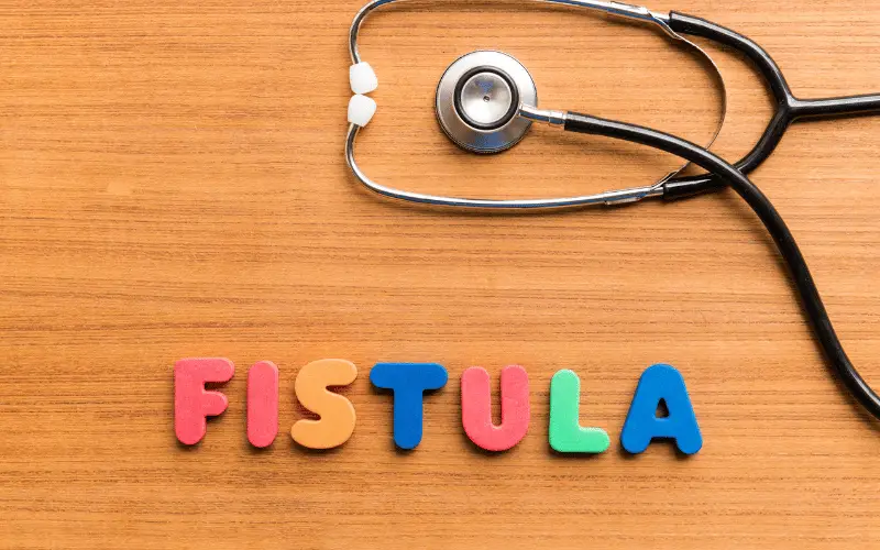 Anal Fistula Alert 10 Symptoms That Should Prompt a Doctor’s Visit