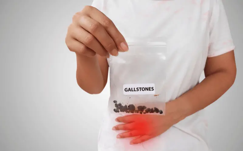 Gallstones The Signs and Symptoms to Know