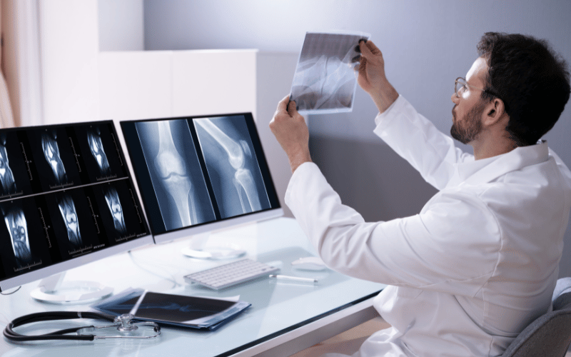 Osteoid Osteoma Explained A Closer Look at Bone Health