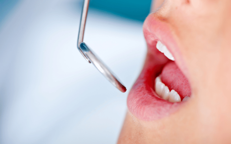 Regular Dental Check-ups The Vanguard of Oral Health