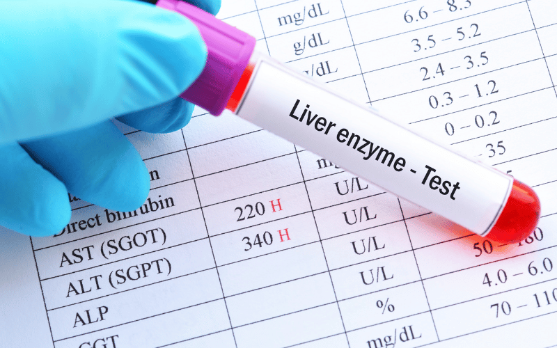 Elevated Liver Enzymes Reading the Signs