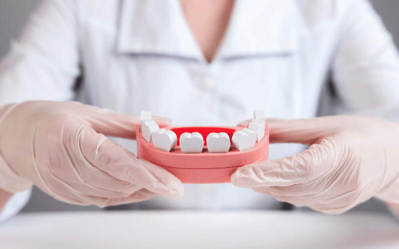 Visible Pockets Between Teeth and Gums A Hallmark of Periodontal Disease