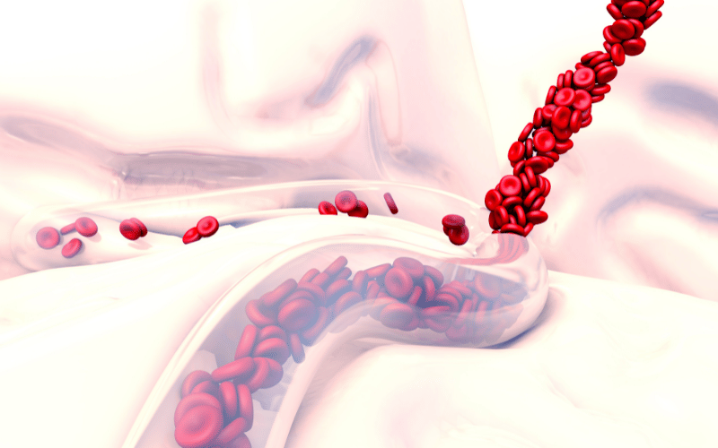 Variceal Hemorrhage A Dire Warning from Within