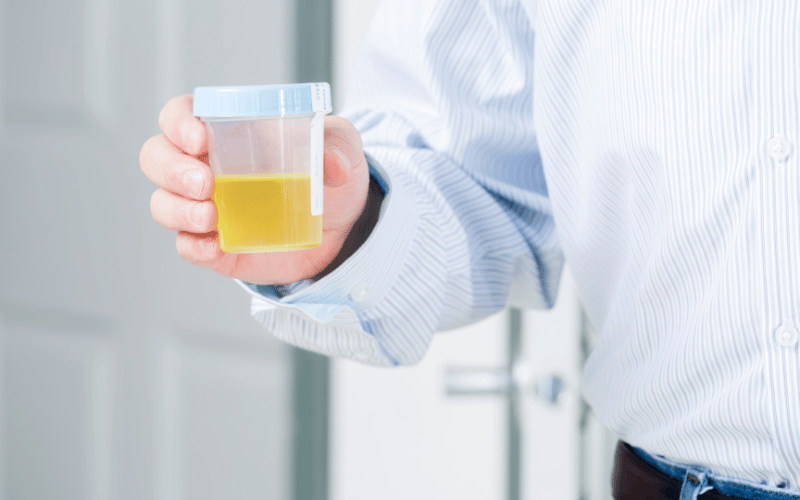 Decreased Urine Output The Underlying Warning of Kidney Concerns in SBP