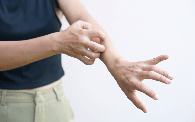 Dry, Itchy Skin The Subtle Dermatological Sign of T1D