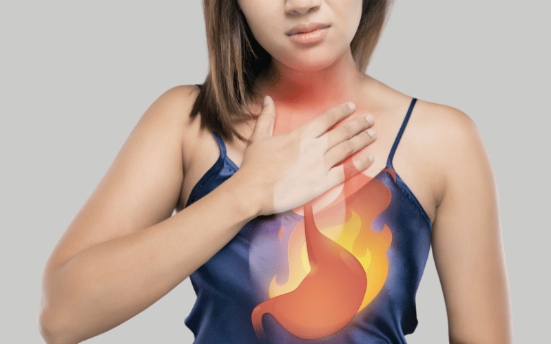 Heartburn and Acid Reflux The Burning Disturbance