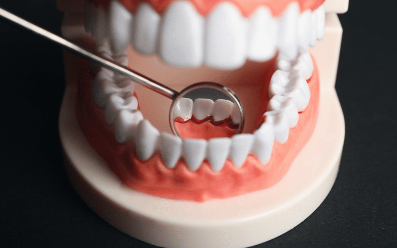 Impact on Oral Health and Functionality