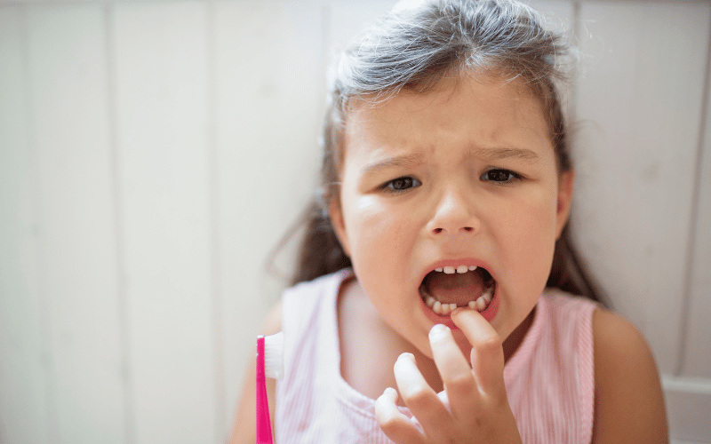 Loose Teeth An Unexpected Consequence of Gingivitis