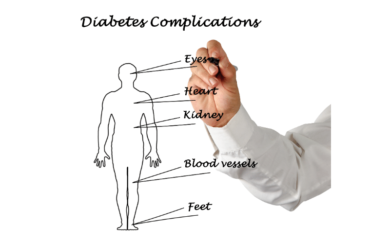 Long-Term Complications of Unmanaged Type 2 Diabetes