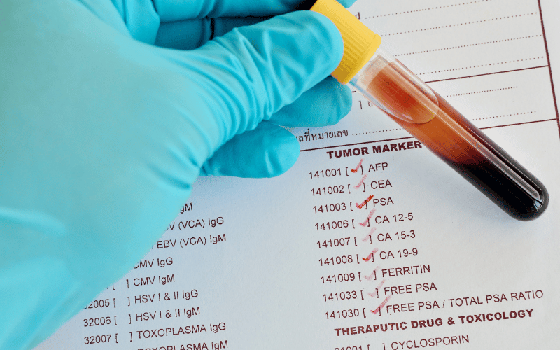 Basophilia as a Marker for Hematologic Disorders