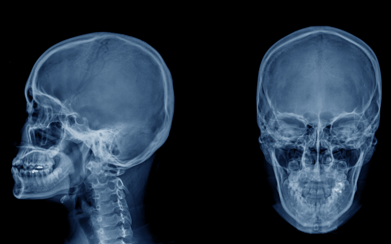 Craniofacial Abnormalities - More Than Meets the Eye