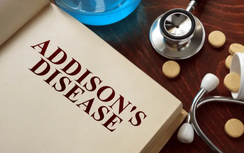 Decoding Addison's Disease