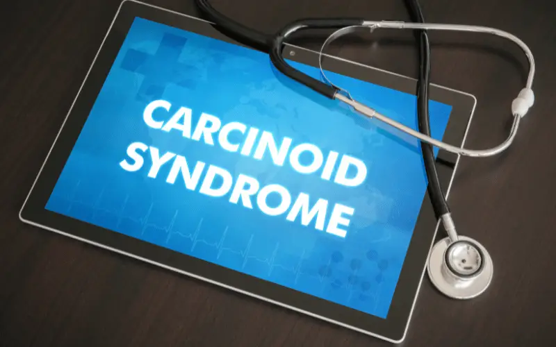 Delving into Carcinoid Syndrome