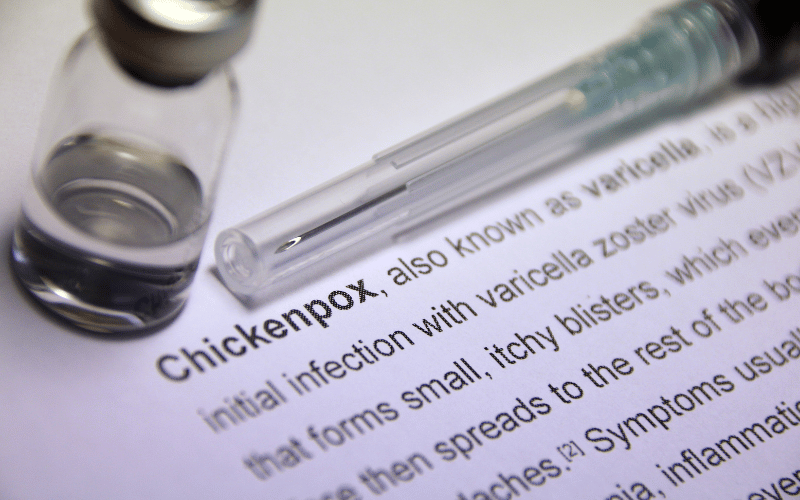 Frequently Asked Questions About Chickenpox