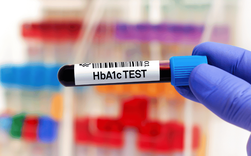 Frequently Asked Questions about Glycated Hemoglobin (HbA1c)