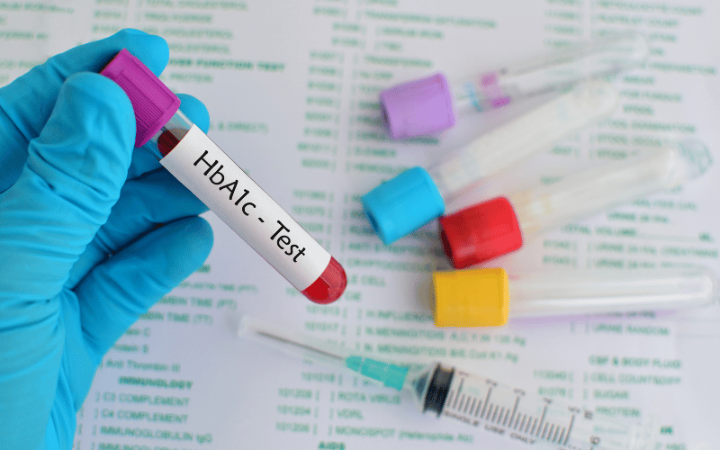 HbA1c’s Role in Long-Term Blood Sugar Monitoring