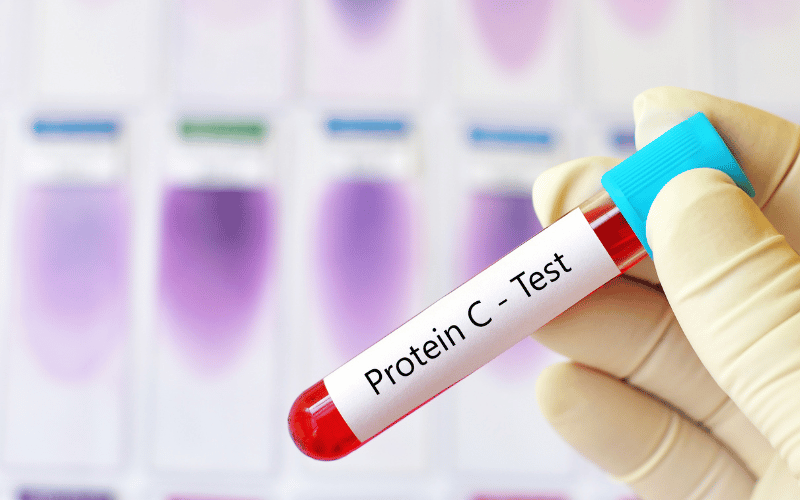 Navigating the Complexities of Protein C Deficiency