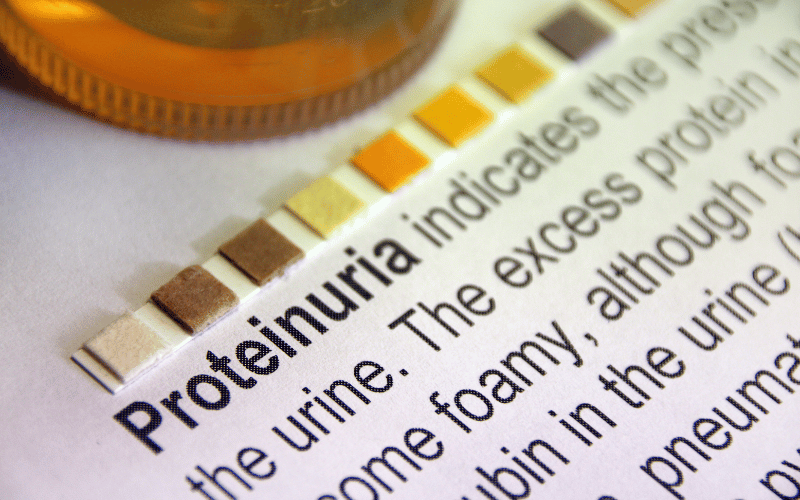 Proteinuria – The Overflow of Protein in Urine