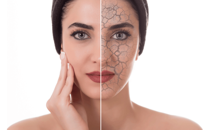 Skin Changes - The Body's Canvas Speaks