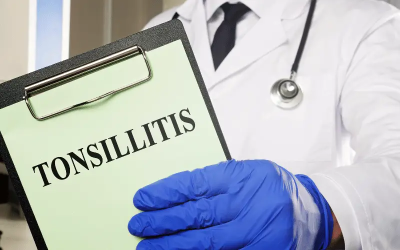 Ultimate Guide to Understanding Tonsillitis 15 Key Facts