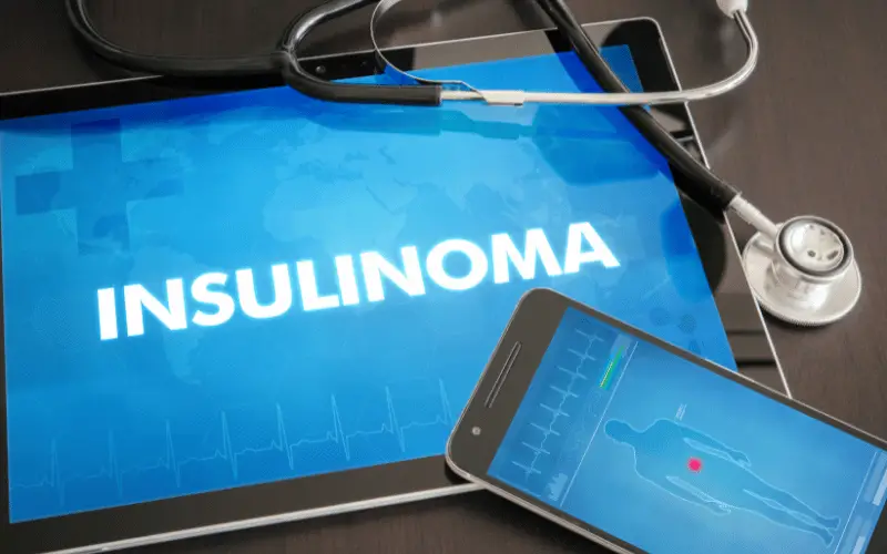 Understanding Insulinoma 10 Key Symptoms to Recognize