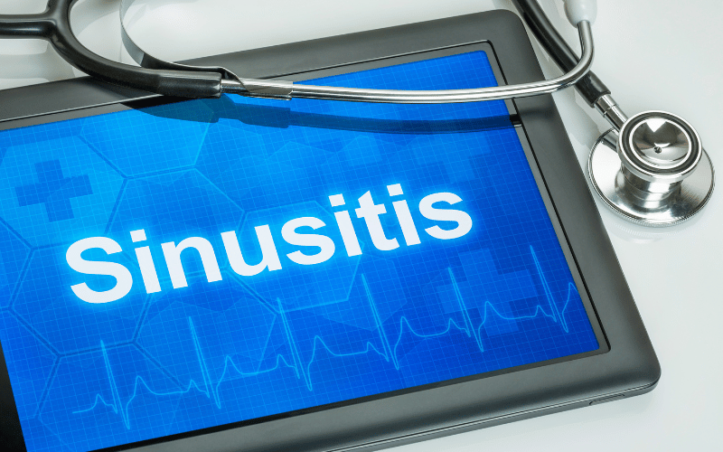 Unlocking the Mysteries of Sinusitis A Deep Dive into Its 10 Telltale Symptoms