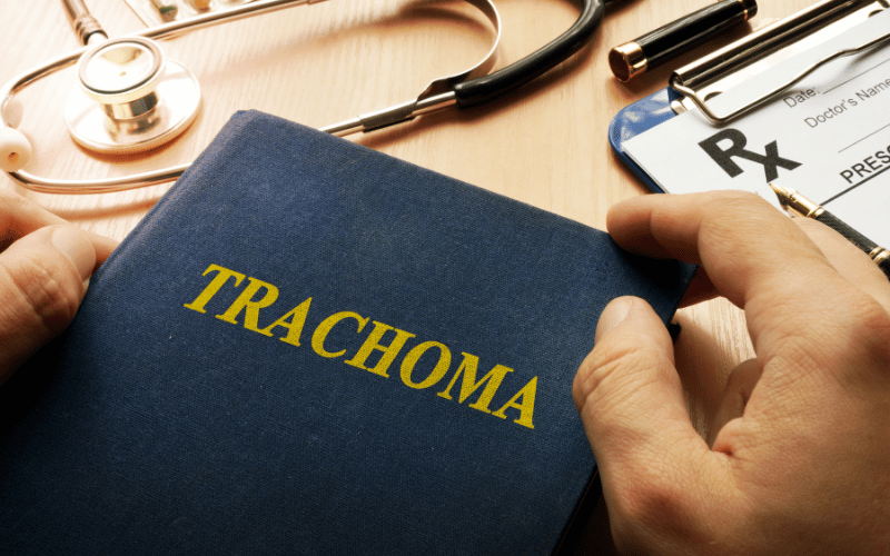 Unraveling the Mystery of Trachoma A Comprehensive Guide to its Ten Telltale Symptoms